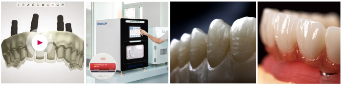 Discover the Future of Dental Excellence with HUGE Digitalife<ALIMT >™</ALIMT> 9