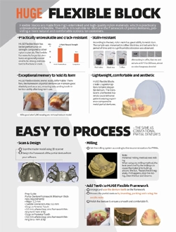 كتلة مرنة ضخمة