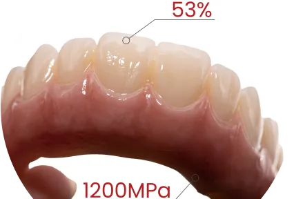 جاهز للقوس الكامل. الجماليات متضمنة.  شاهد زركونيا MM-4D في حالات إكلينيكية حقيقية